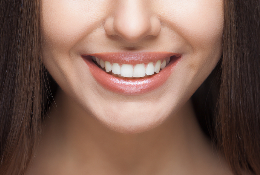Woman smile. Teeth whitening. Dental care.