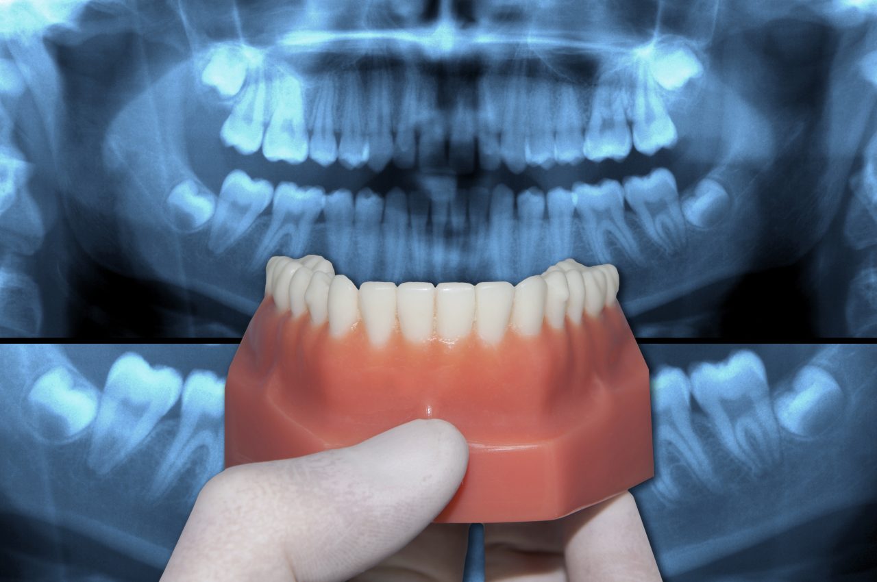 iStock-541124596