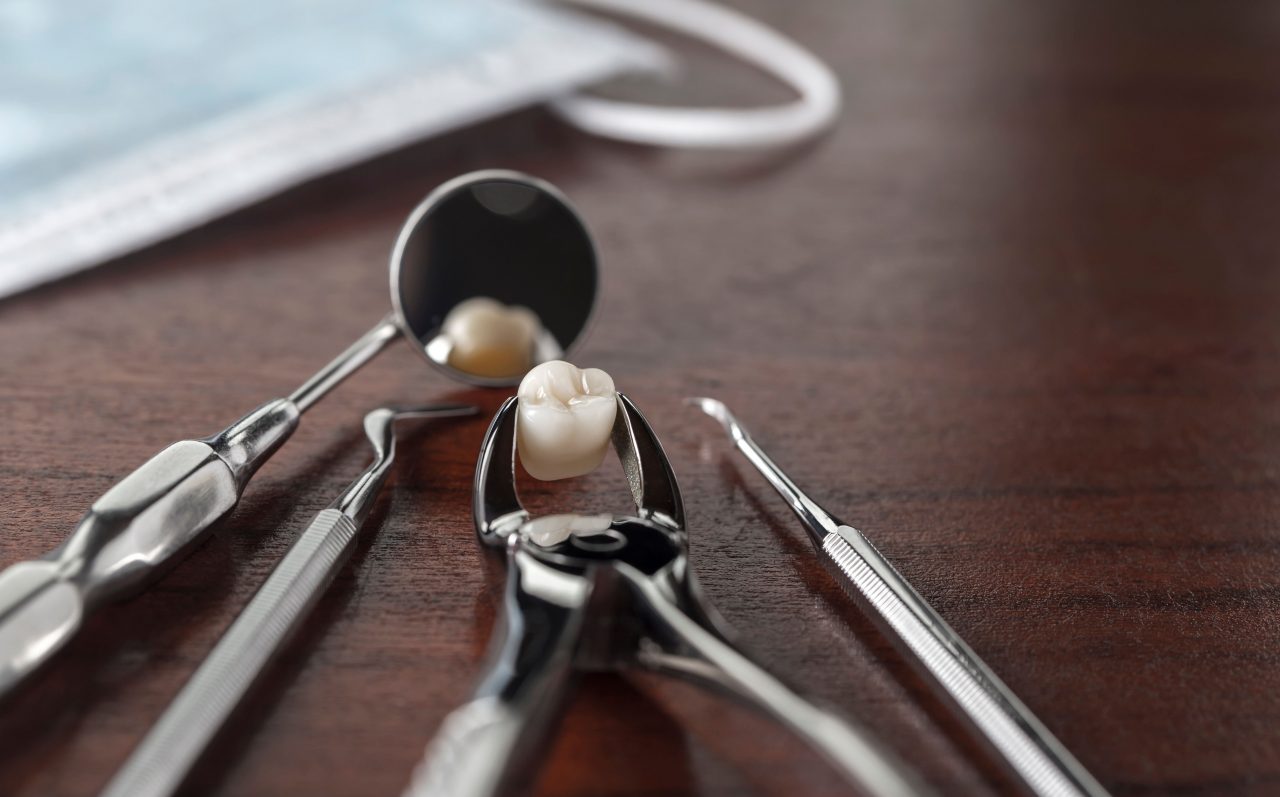 Tooth_extraction