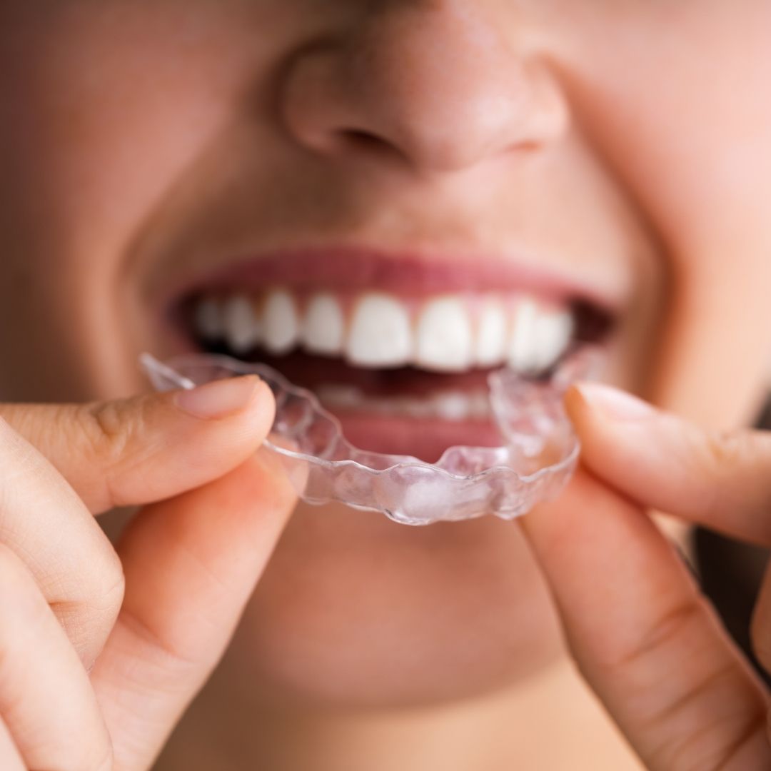 Bruxism1