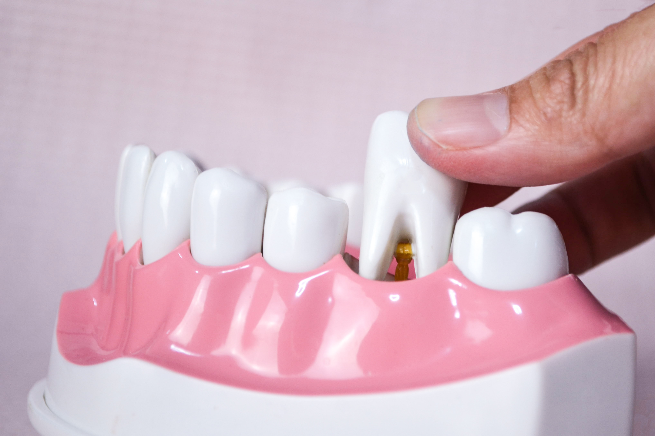 teeth modell