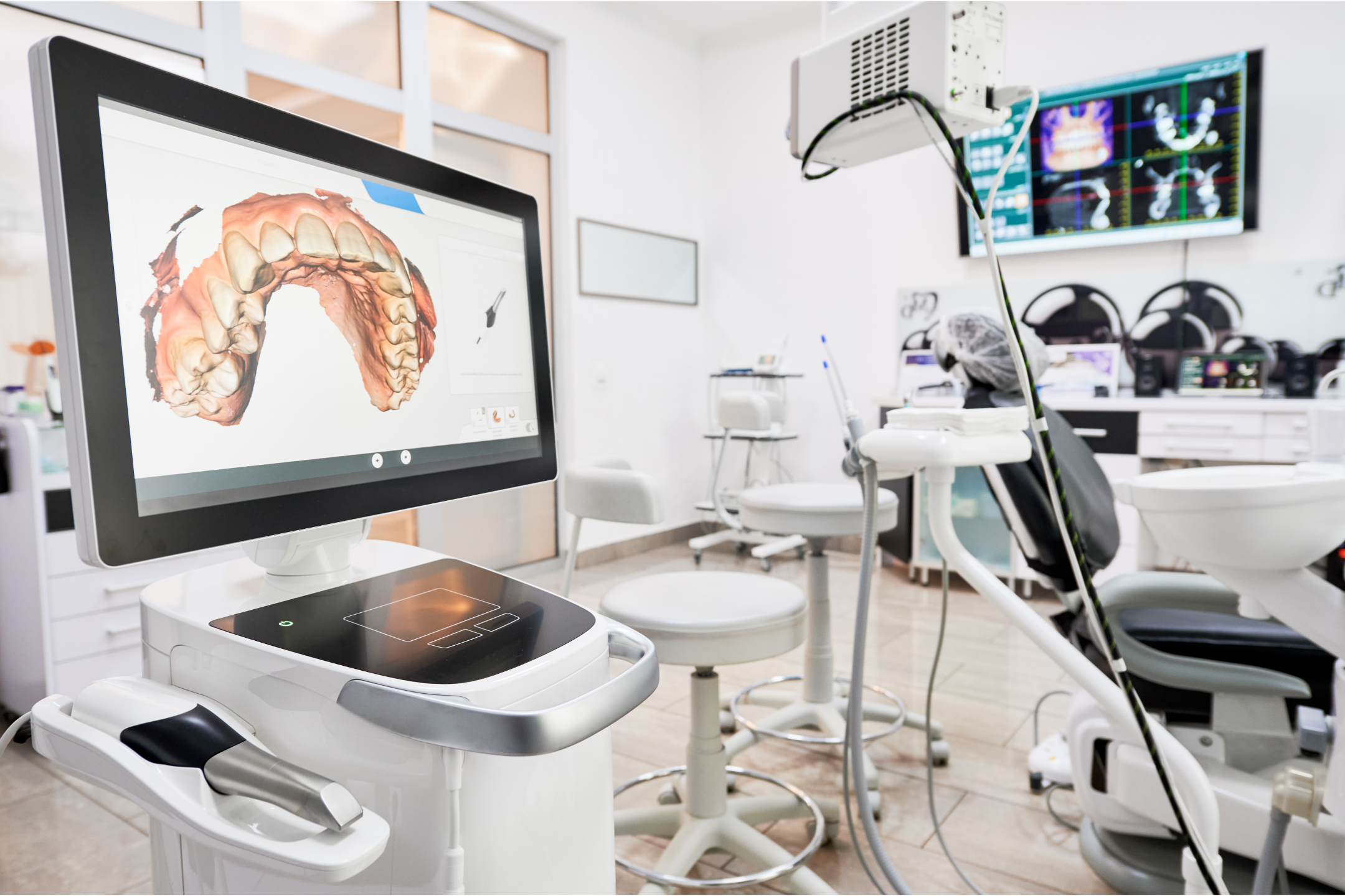 oral scanner