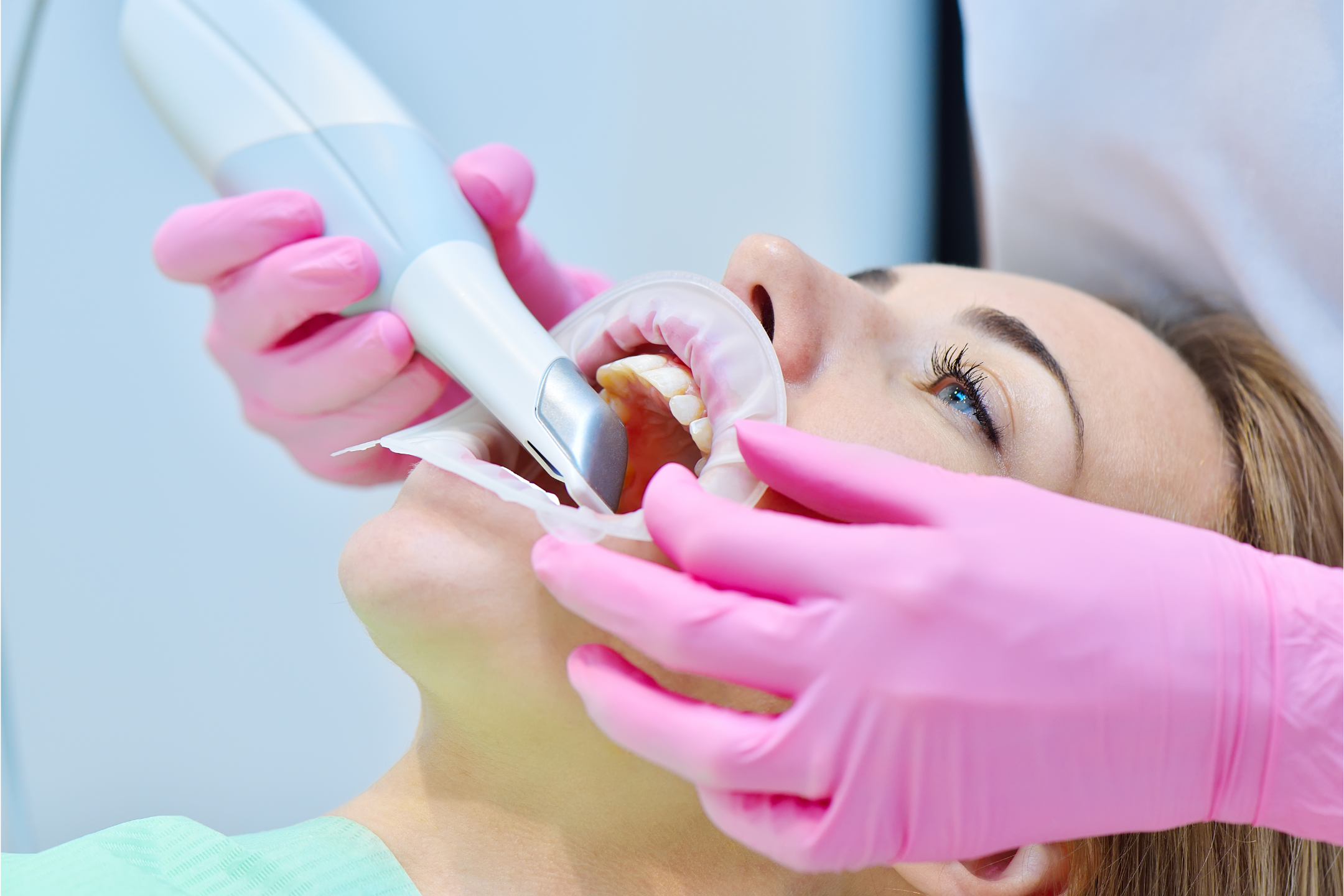 oral scanner